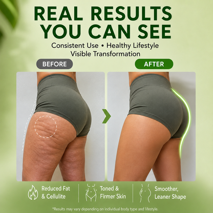 SlimFit Bur Thermo Slimming Gel for a Firmer, Smoother-Looking Body