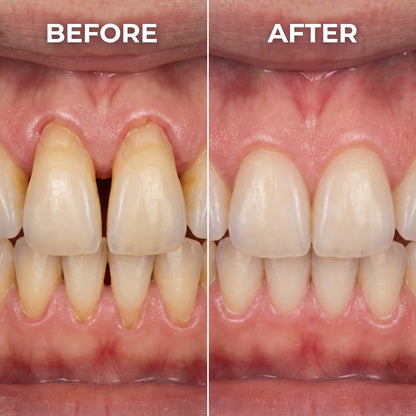 Gum Protect REPAIR GEL