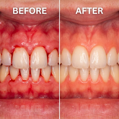 Gum Protect REPAIR GEL